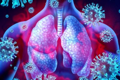 Coronavirus ARDS (CARDS) - Healing a Broken Lung