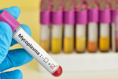 vial being tested for the presence of mycoplasma