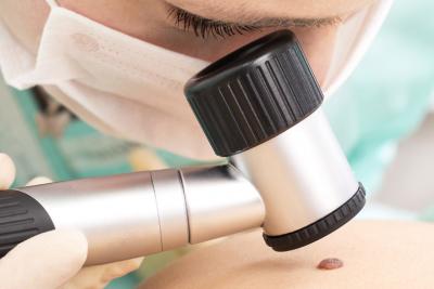 Thanks to Immunotherapy, Melanoma Deaths are Declining