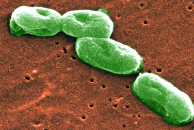 A Scary Microbial Complex is on the Move