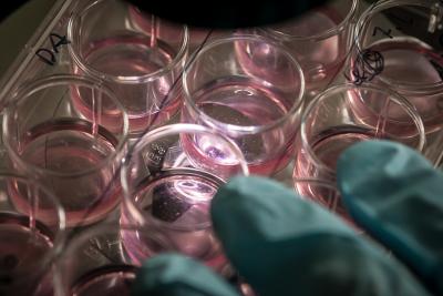 An Alternative Source of Pluripotent Stem Cells