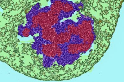 What's Hot in 2020: Pathology