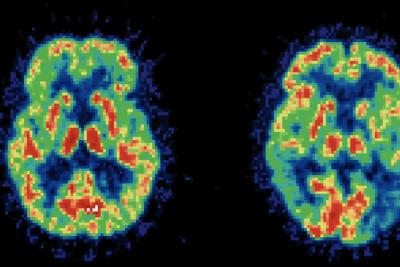 The Quest for Clinically Translatable Data