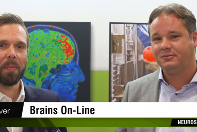 Capturing Brain Molecules in Cellular Space (Video)