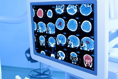 The Invention of Computed Tomography