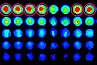 Shining a Light on Cancer