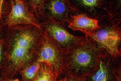 Cell Lines or Animals