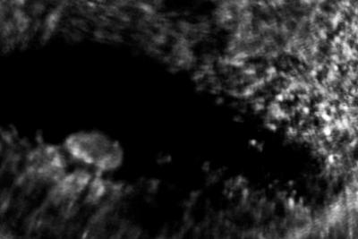 A New Window Into the Animal Eye