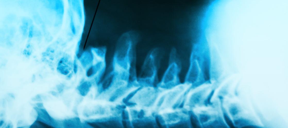Intrathecal Dosing in large animals