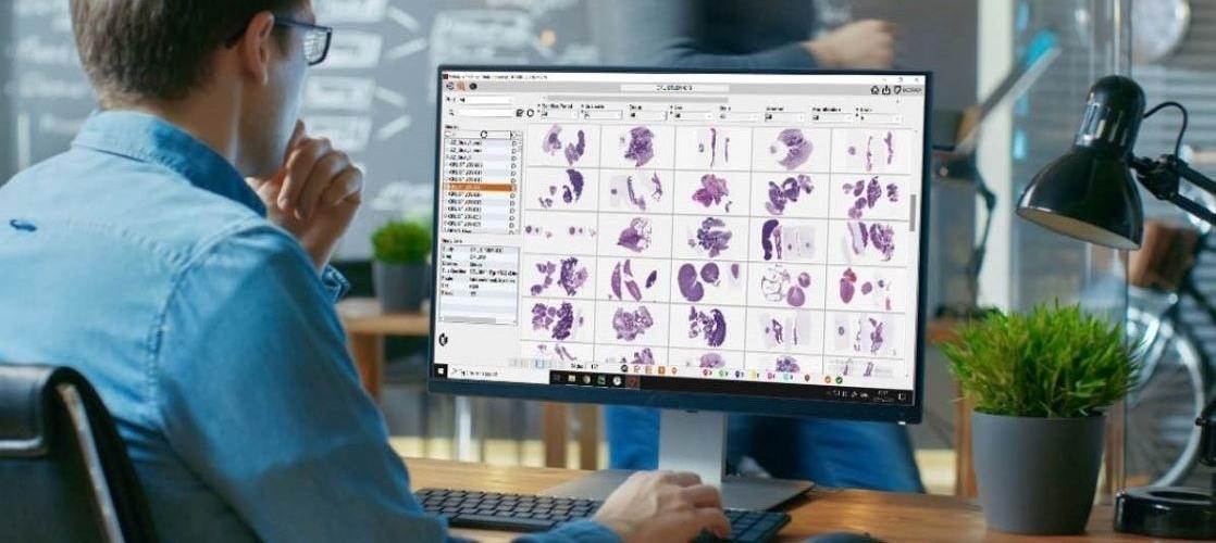 Pathologist looking at computer