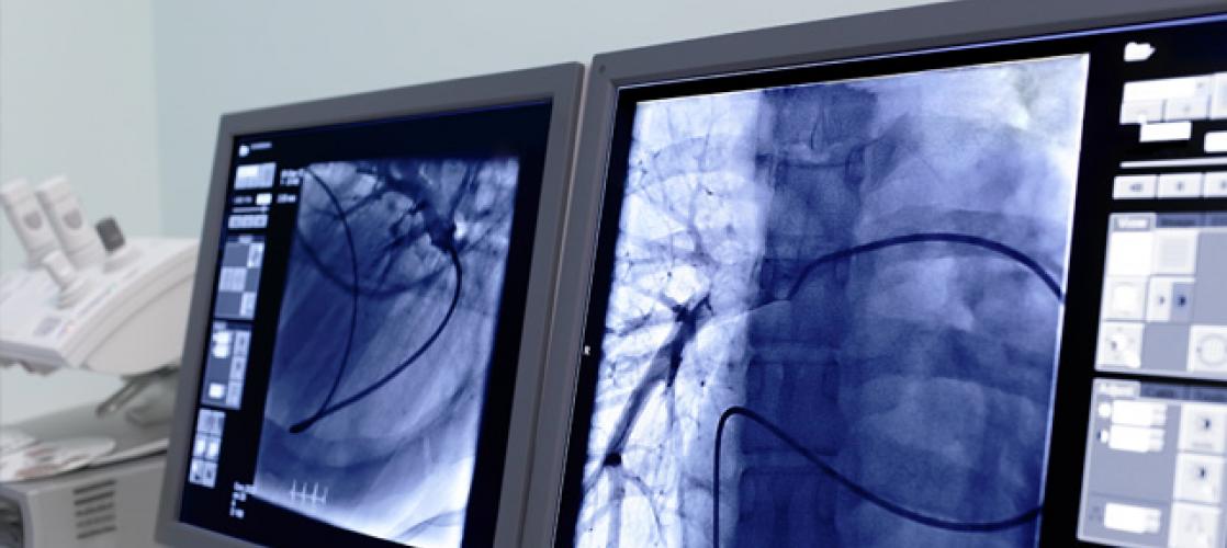 lung radiology