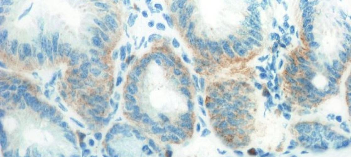 Tissue Binding Expertise for Your Antibody Development